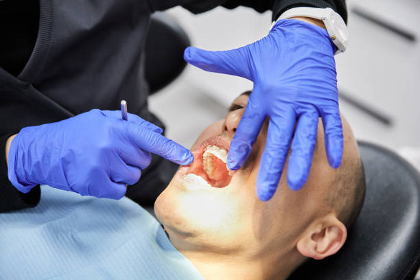 Best Knocked-Out Tooth Emergency  in Socorro, TX