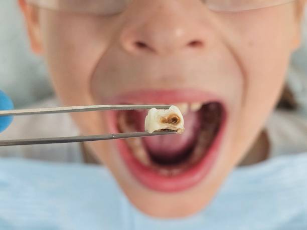 Best Dentist for Severe Toothache  in Socorro, TX